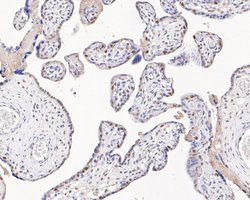 Invitrogen MSH2 Monoclonal Antibody (10G2) 100 &mu;L | Buy Online | Invitrogen&trade; | Fisher Scientific