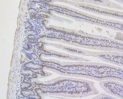 Invitrogen MSH2 Monoclonal Antibody (10G2) 100 &mu;L | Buy Online | Invitrogen&trade; | Fisher Scientific