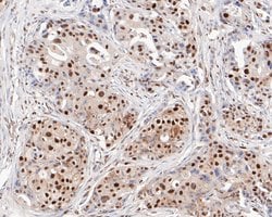 Invitrogen MSH2 Monoclonal Antibody (10G1) 100 &mu;L; Unconjugated:Antibodies,