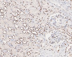 Invitrogen MSH2 Monoclonal Antibody (10G1) 100 &mu;L; Unconjugated:Antibodies,
