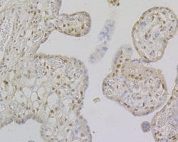 Invitrogen MSH2 Monoclonal Antibody (10G1) 100 &mu;L; Unconjugated:Antibodies,