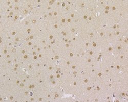 Invitrogen MSH2 Monoclonal Antibody (10G1) 100 &mu;L; Unconjugated:Antibodies,