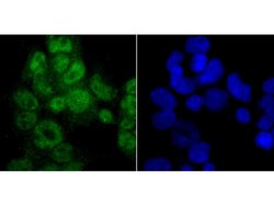 Invitrogen PTBP1 Monoclonal Antibody (9A1) 100 &mu;L; Unconjugated:Antibodies,