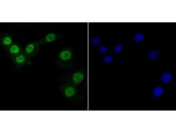 Invitrogen PTBP1 Monoclonal Antibody (9A1) 100 &mu;L; Unconjugated:Antibodies,