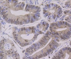 Invitrogen PTBP1 Monoclonal Antibody (9A1) 100 &mu;L; Unconjugated:Antibodies,