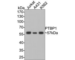 Invitrogen PTBP1 Monoclonal Antibody (9A1) 100 &mu;L; Unconjugated:Antibodies,