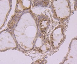 Invitrogen Calreticulin Monoclonal Antibody (7B2) 100 &mu;L; Unconjugated:Antibodies,