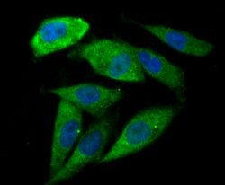 Invitrogen IL-6 Monoclonal Antibody (1-6) 100 &mu;L | Buy Online | Invitrogen&trade; | Fisher Scientific