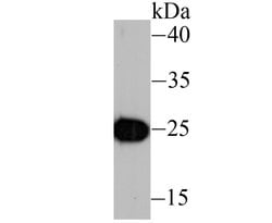 Invitrogen IL-6 Monoclonal Antibody (1-6) 100 &mu;L | Buy Online | Invitrogen&trade; | Fisher Scientific