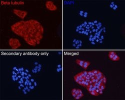 Invitrogen beta Tubulin Monoclonal Antibody (1-B11) 100 &mu;L; Unconjugated:Antibodies,