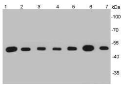 Invitrogen beta Tubulin Monoclonal Antibody (1-B11) 100 &mu;L; Unconjugated:Antibodies,