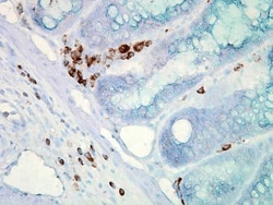 Invitrogen HSP70 Monoclonal Antibody (C92F3A-5), PerCP 200 &mu;g; PerCP:Antibodies,