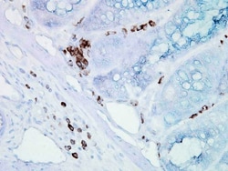 HSP70/HSC70 Monoclonal Antibody (BB70), APC, Invitrogen 200 &mu;g; APC:Antibodies,