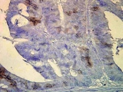 Invitrogen HSP70/HSC70 Monoclonal Antibody (BB70), FITC 200 &mu;g; FITC:Anticorps,