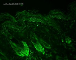 Invitrogen HSP60 Monoclonal Antibody (LK1), FITC 200 &mu;g; FITC:Antibodies,
