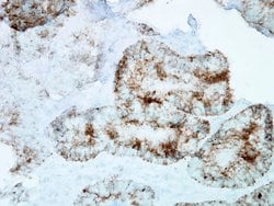 Invitrogen HSP60 Monoclonal Antibody (LK1), FITC 200 &mu;g; FITC:Antibodies,