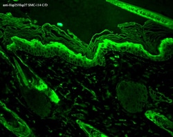 Invitrogen HSP27 Monoclonal Antibody (8A7), FITC 100 &mu;g; FITC:Antibodies,
