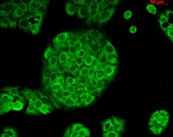 Invitrogen CD74 Monoclonal Antibody (PIN.1), PerCP 100 &mu;g; PerCP:Antibodies,