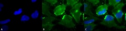 Invitrogen CD74 Monoclonal Antibody (PIN.1), PerCP 100 &mu;g; PerCP:Antibodies,