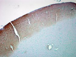 Invitrogen CaMKII alpha Monoclonal Antibody (6G9), PerCP 100 &mu;g | Buy Online | Invitrogen&trade; | Fisher Scientific