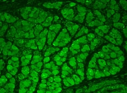 Invitrogen CaMKII alpha/beta Monoclonal Antibody (22B1), FITC 100 &mu;g;