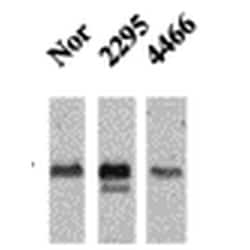 Invitrogen CaMKII alpha/beta Monoclonal Antibody (22B1), FITC 100 &mu;g;