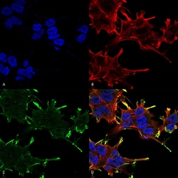 Invitrogen CRYAB Monoclonal Antibody (1A7.D5), FITC 200 &mu;g; FITC:Antibodies,