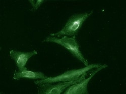 Invitrogen AHA1 Monoclonal Antibody (25F2.D9), PE 100 &mu;g; PE:Antibodies,