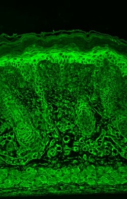 Invitrogen HIF-1 alpha Monoclonal Antibody (ESEE122), FITC 100 &mu;g; FITC:Antibodies,