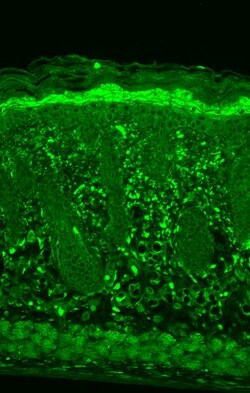 Invitrogen HSPB8 Monoclonal Antibody (3C12-H11), APC 100 &mu;g; APC:Antibodies,