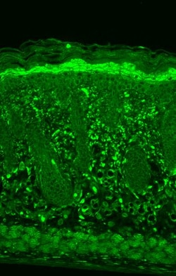 HSPB8 Monoclonal Antibody (3C12-H11), PE, Invitrogen 100 &mu;g; PE:Antibodies,