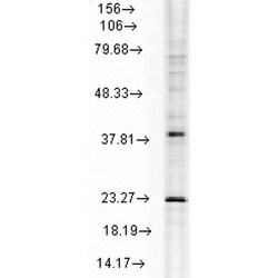 HSPB8 Monoclonal Antibody (3C12-H11), PE, Invitrogen 100 &mu;g; PE:Antibodies,