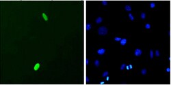 Invitrogen DUX4 Monoclonal Antibody (P2B1), PerCP 100 &mu;g; PerCP:Antibodies,