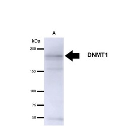 Invitrogen DNMT1 Monoclonal Antibody (60B1220.1), APC 100 &mu;g; APC:Antibodies,