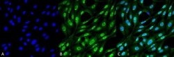 Invitrogen Ubiquitin Monoclonal Antibody (FK2), APC 100 &mu;g | Buy Online | Invitrogen&trade; | Fisher Scientific