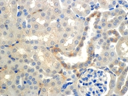 Invitrogen SCNN1B Monoclonal Antibody (7B8), PerCP 100 &mu;g; PerCP:Antibodies,