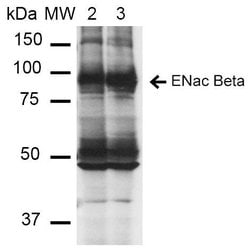 Invitrogen SCNN1B Monoclonal Antibody (16E4), PerCP 100 &mu;g; PerCP:Antibodies,