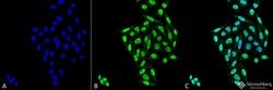 Invitrogen PP5 Monoclonal Antibody (12F7), APC 100 &mu;g; APC:Antibodies,