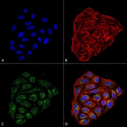 Invitrogen CD74 Monoclonal Antibody (1B8), APC 100 &mu;g; APC:Antibodies,
