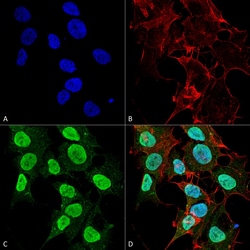 Invitrogen CaV1.2 Monoclonal Antibody (S57), FITC 100 &mu;g; FITC:Antibodies,
