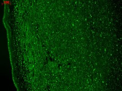 Invitrogen CaV3.2 Monoclonal Antibody (N55/10), PE 100 &mu;g; PE:Antibodies,