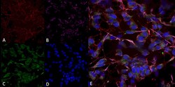 Invitrogen HCN2 Monoclonal Antibody (S71), FITC 100 &mu;g; FITC:Antibodies,