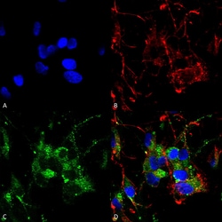 Invitrogen HCN2 Monoclonal Antibody (S71), PE 100 &mu;g; PE:Antibodies,