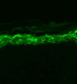 Invitrogen SCN9A Monoclonal Antibody (N68/6), APC 100 &mu;g; APC:Antibodies,