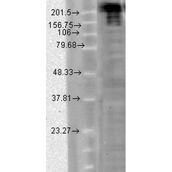 Invitrogen SCN9A Monoclonal Antibody (N68/6), PerCP 100 &mu;g; PerCP:Antibodies,