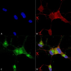 Invitrogen SCN9A Monoclonal Antibody (N68/6), PE 100 &mu;g; PE:Antibodies,