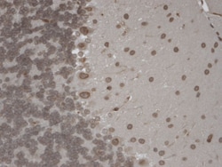 Invitrogen TRPM7 Monoclonal Antibody (S74), APC 100 &mu;g; APC:Antibodies,
