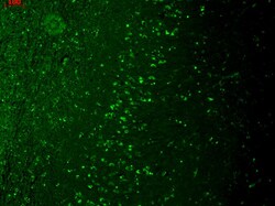 Invitrogen TRPM7 Monoclonal Antibody (S74), PE 100 &mu;g | Buy Online | Invitrogen&trade; | Fisher Scientific