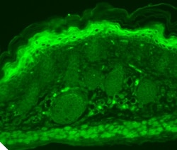Invitrogen TRPV3 Monoclonal Antibody (N15/4), APC 100 &mu;g; APC:Antibodies,