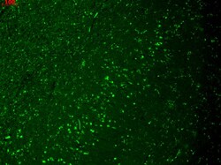 Invitrogen HCN4 Monoclonal Antibody (N114/10), FITC 100 &mu;g; FITC:Antibodies,